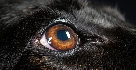 Primary Open Angle Glaucoma